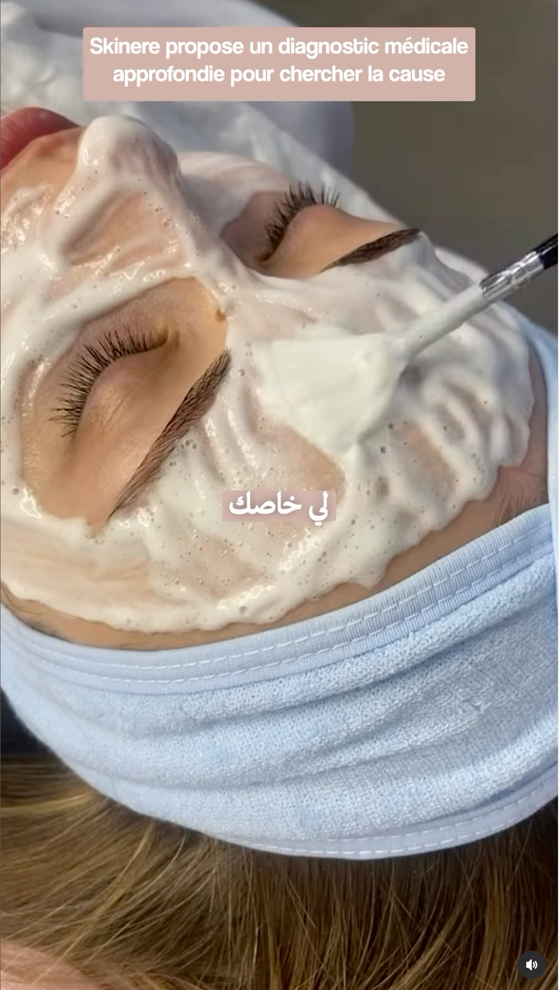 SKINERE - Post Instagram 6