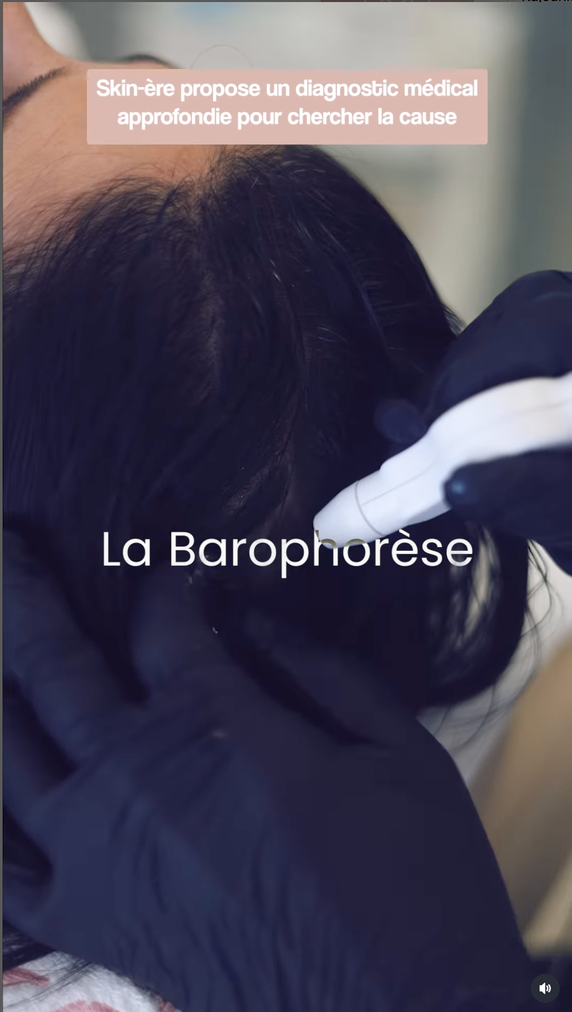 SKINERE - Post Instagram 4